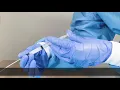 How to use Surfcath a catheter for smoother administration of surfactant in premature babies
