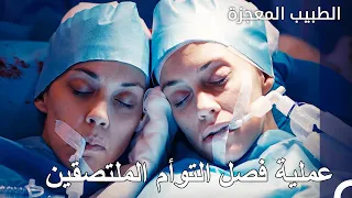 جراحة فصل التوأم - الطبيب المعجزة