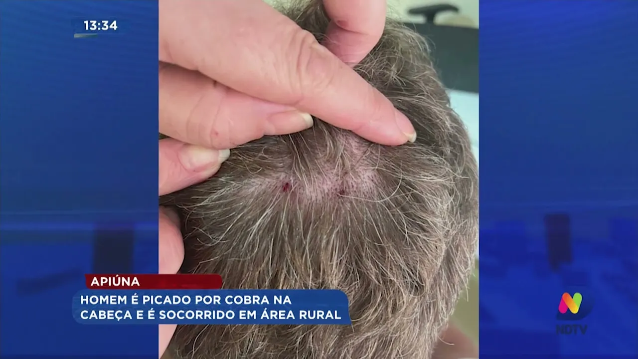 Homem é picado por cobra na cabeça e é socorrido em área rural em Apiúna