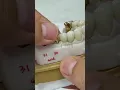 Veneers with 14 kt gold implants