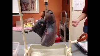 آثار التدخين على صحة رئة المدخن شي لا يصدق  آثار التدخين على صحة رئة المدخن شي لا يصدق