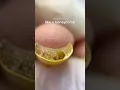 Didn t expect to find this inside her nails