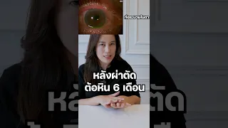  ตาต้อหินแบบแผนเล็กคืออะไร และทำอย่างไรเพื่อลดความดันในตา 