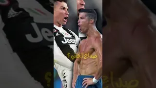 صداع جتني دوخه كريستيانو رونالدو صداع دندنها