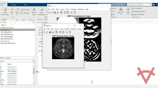 IMAGE COMPRESSION AND DECOMPRESSION USING STATIONARY WAVELET TRANSFORM
