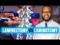 Laminectomy vs Laminotomy Spinal Decompression Explained