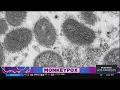 Know the facts about Monkeypox and the vaccine to fight it