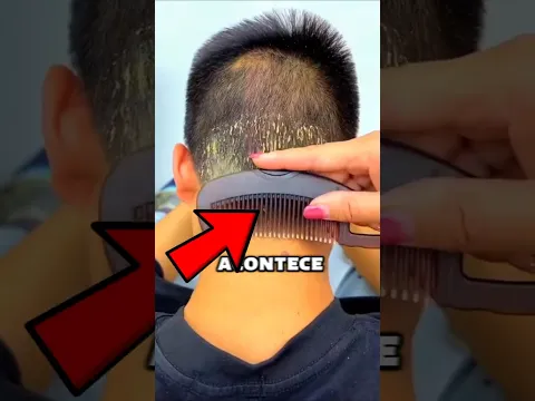 Colocaram Caspa no Microscópio e Olha o Que Aconteceu‼️🤯