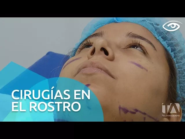 Download MP3 Cirugías en el rostro - Día a Día - Teleamazonas