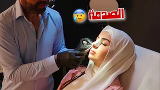 نتيجة عملية تجميل أنفي!! بكيت😭