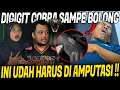 Download Lagu NOLONG KORBAN GIGITAN ULAR COBRA PENYEMBUR !! TANGANNYA UDAH BOLONG DAN BERN4N4H !!