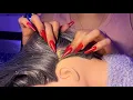 Download Lagu ASMR Dandruff Removal🎧💤, Dandruff Scratching, Removing Huge Flakes⚡(Whispers)
