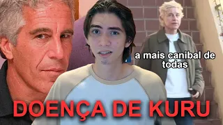 KURU: A DOENÇA FATAL QUE SUPOSTAMENTE INFECTOU HOLLYWOOD