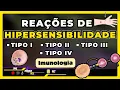 Channel