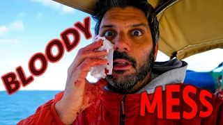 Injury at Sea (Calico Skies Sailing, Ep. 79)