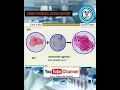 HVS High Vaginal Swab Complete Examination interpretation