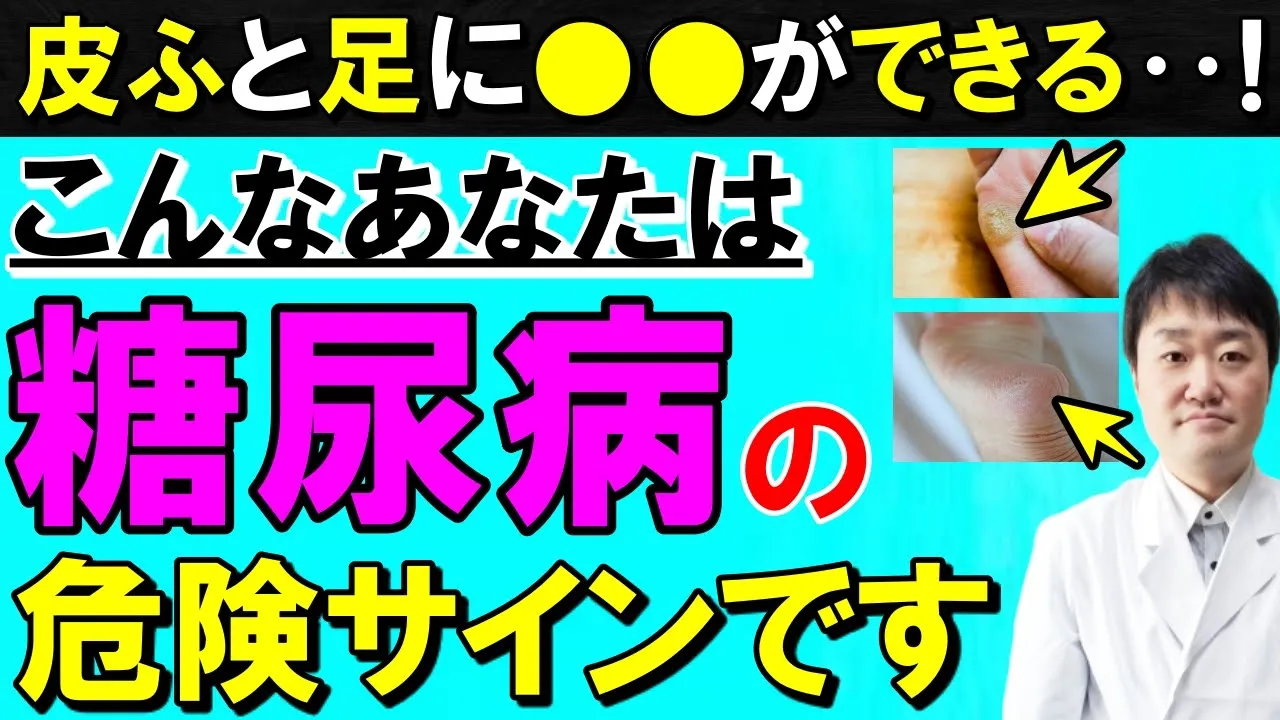 【放置禁止】実は糖尿病になっていると出やすい意外な「皮膚と足」の変化 医師が解説