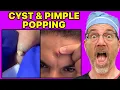 Lagu Plastic Surgeon Reacts To SATISFYING Pimple and Cyst Popping