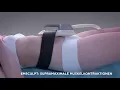Апарат для корекції фігури EMS