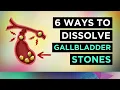 How To Dissolve Gallstones Causes Treatment