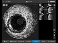 IntraSight Intuitive Interface