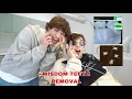 NICK GETS HIS WISDOM TEETH REMOVED