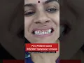 Download Lagu INSTANT temporary tooth caps in 15 minutes! Dr. Srishti Bhatia #smiletransformation