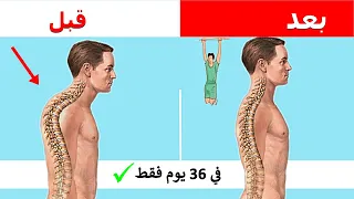 The 4 Best Exercises To Get Rid Of The Arch Of The Back Permanently Forward Curvature Treatment 