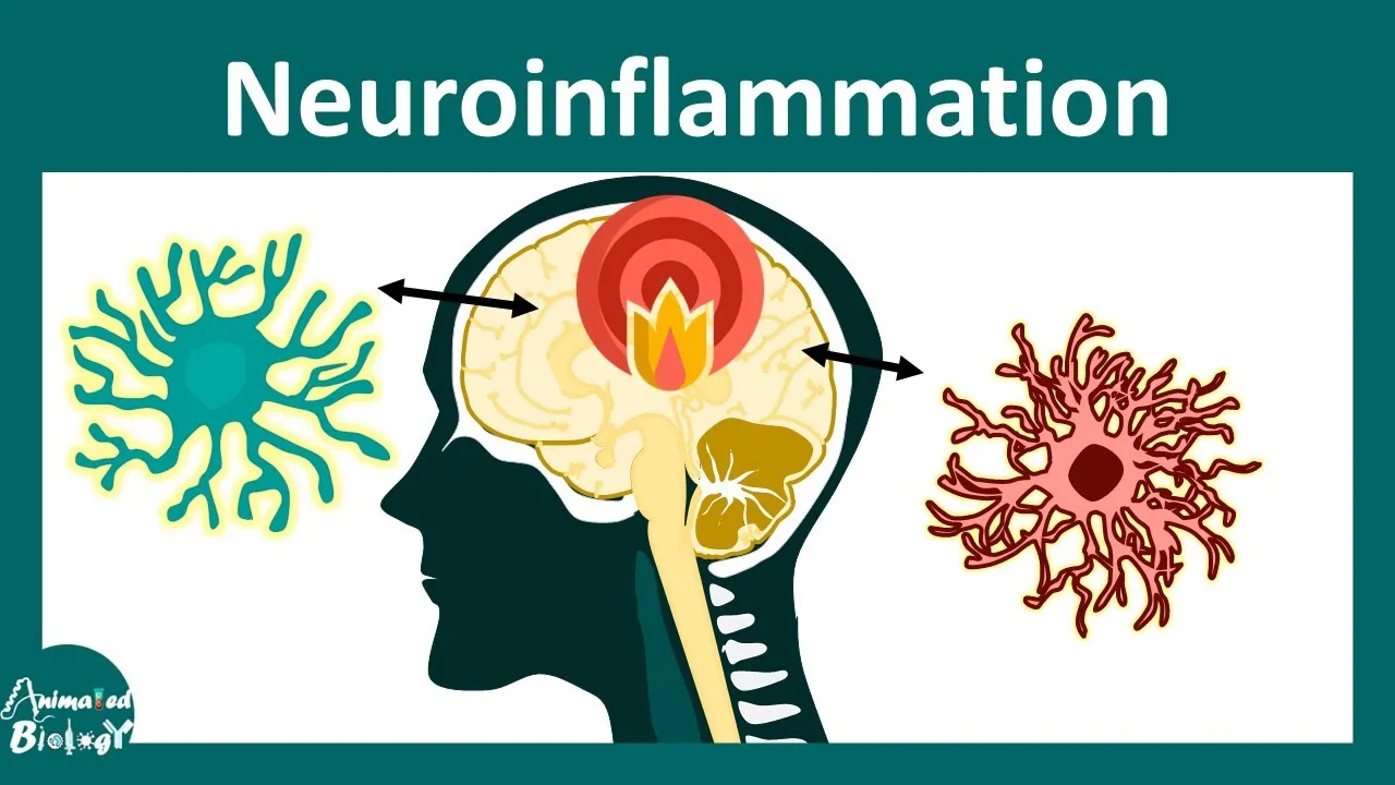Neuroinflammation | Role of microglia in Neuroinflammation