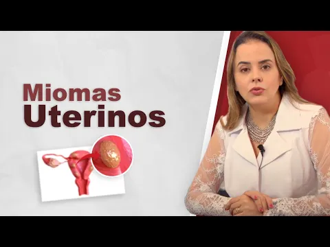 Download MP3 Miomas uterinos. Leiomiomas no útero. Mal muito frequente.