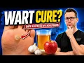 Treating Warts at Home Is Apple Cider Vinegar Safe