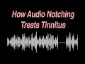 Lagu How Audio Notching Treats Tinnitus