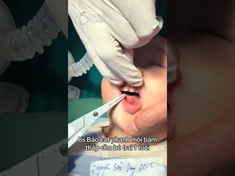 قص شفره الفم لعمر سنه فقط😭 #momlife