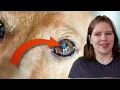 Aging Eyes What You Need to Know About Lenticular Sclerosis
