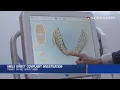 Smile Direct Complaint Investigation