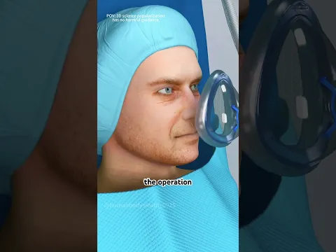 How Liver Transplant Surgery Is Done(3D Animation) #3dmedicalanimation #doctor #medicalanimation