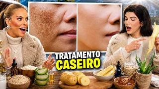 Fiz essas 3 Receitas Caseiras para Tratar MELASMA e MANCHAS no Inverno!