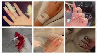 Hand Bandage Dp For Girls Hand Bandage Dp For Girls Accident Dp Ideas 2023 Part 2 