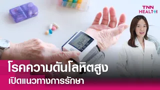 ควรตรวจวัดความดันโลหิตบ่อยแค่ไหน