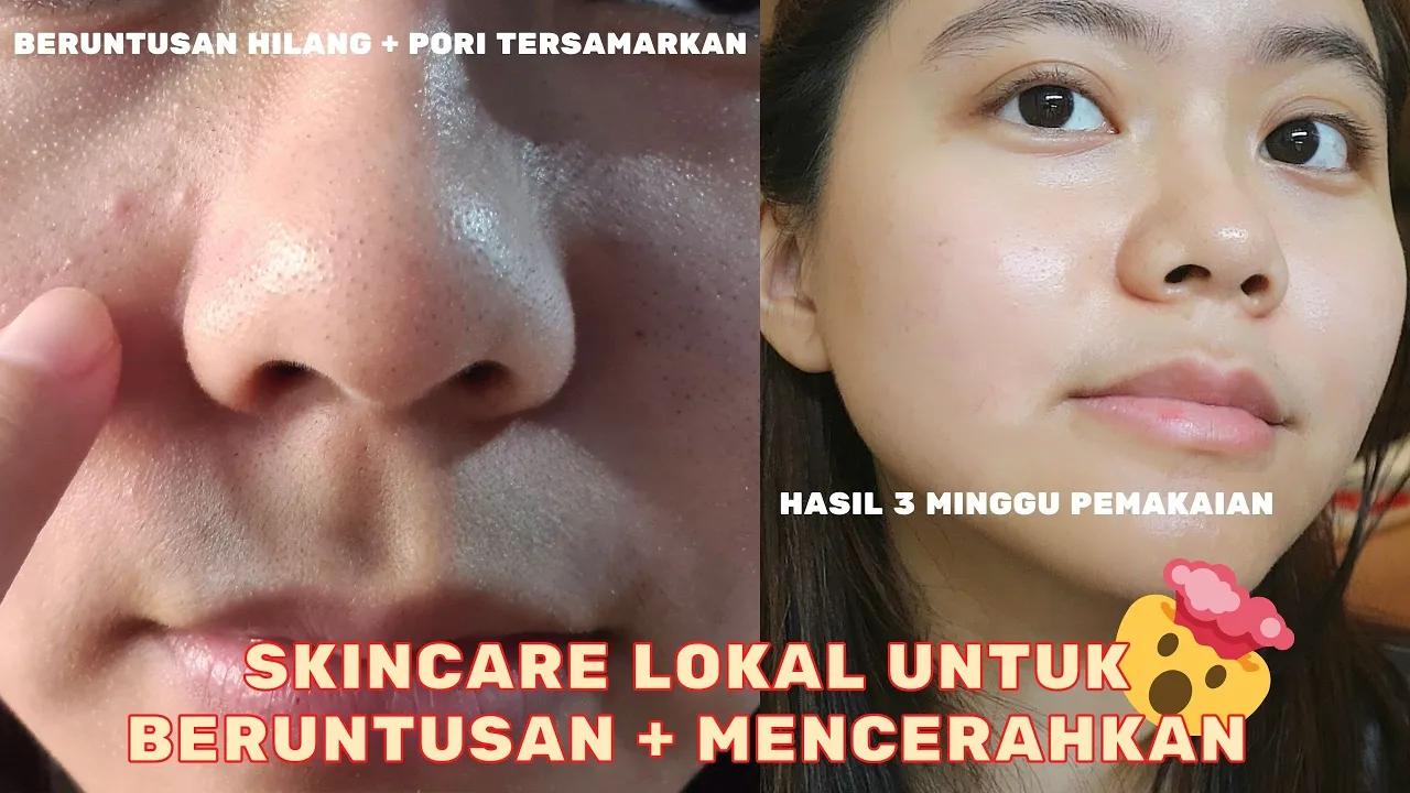 REVIEW LOREAL REVITALIFT SERUM HYALURONIC ACID DI KULIT BERMINYAK!