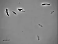 Bacteria exploding after exposure to antibiotics