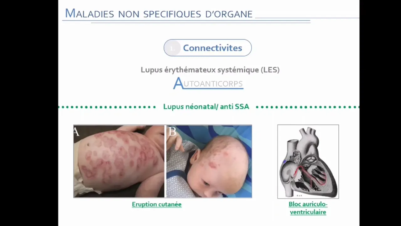 #Fahmeni Auto-anticorps & maladies auto-immunes Docteur Mellal - partie 2
