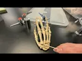 Metacarpals and Phalanges