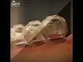 Authentic Cupping Massage Therapy in Dubai Expert Therapists Yinyang Connection Spa
