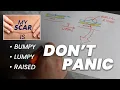 Battling Bumpy Lumpy Incisions After Surgery Healing Ridge