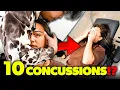 NO MIGRAINE 1ST TIME IN 45 YEARS Dr Tubio 1st Chiropractic Adjustment