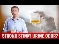 Pee Smells Bad What Causes Strong Stinky Odor After Urination - Dr Berg