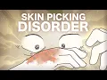 Skin Picking Disorder What is it