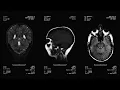 Sevendeaths - Eternal Sprung (Remote Sympathy LP out Feb 24)