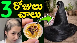 💯% రిజల్ట్:ఉల్లిపాయ, లవంగాలతో  ఇలా చేస్తే 3 రోజుల్లో జుట్టు ఒత్తుగా భయంకరంగా పెరుగుతుంది|Hair Growth